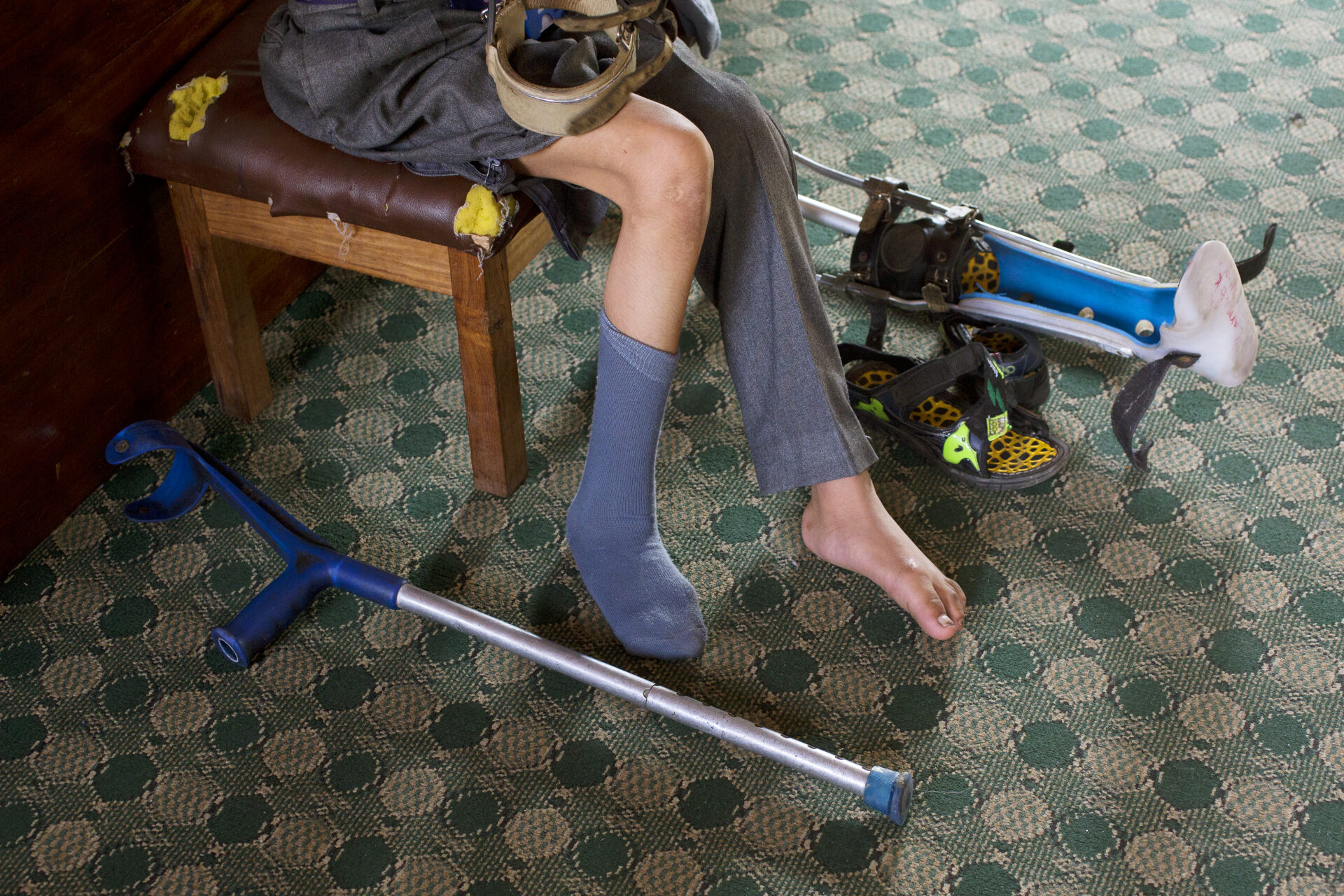 Børn med handikap i Nepal